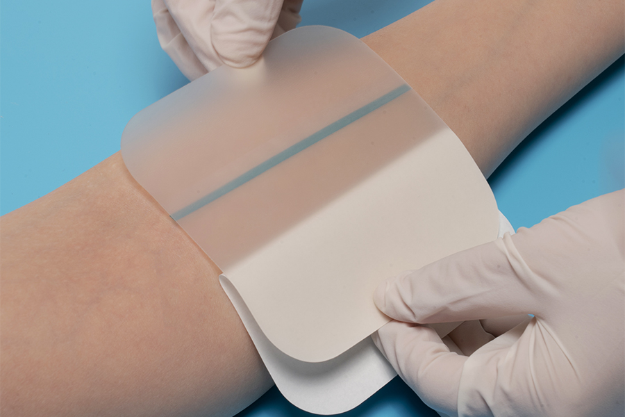 Hydrocolloid Wound Dressing